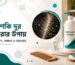 জেনে নিন খুশকি দূর করার উপায়